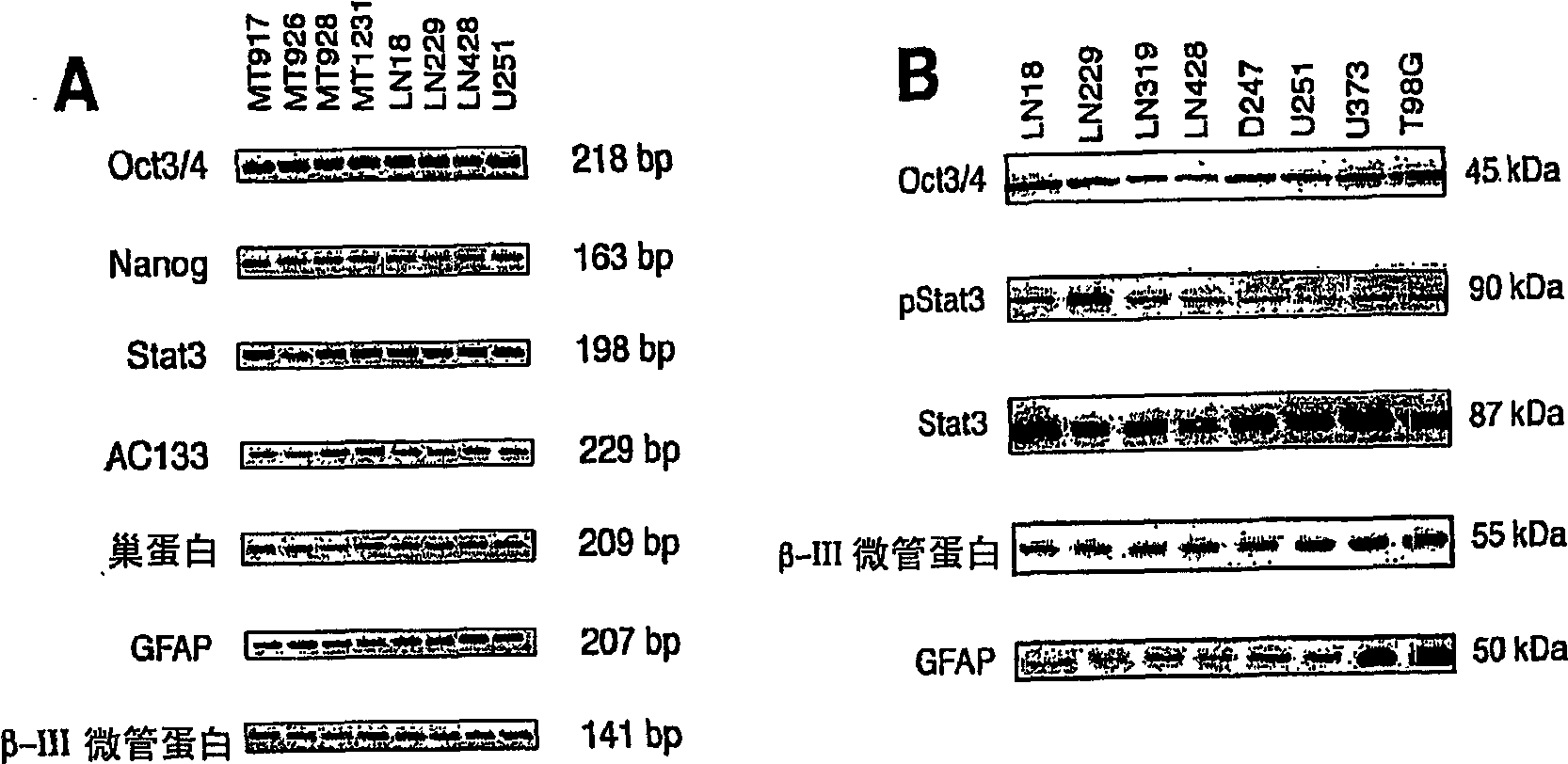 Compositions enriched in neoplastic stem cells and methods comprising same