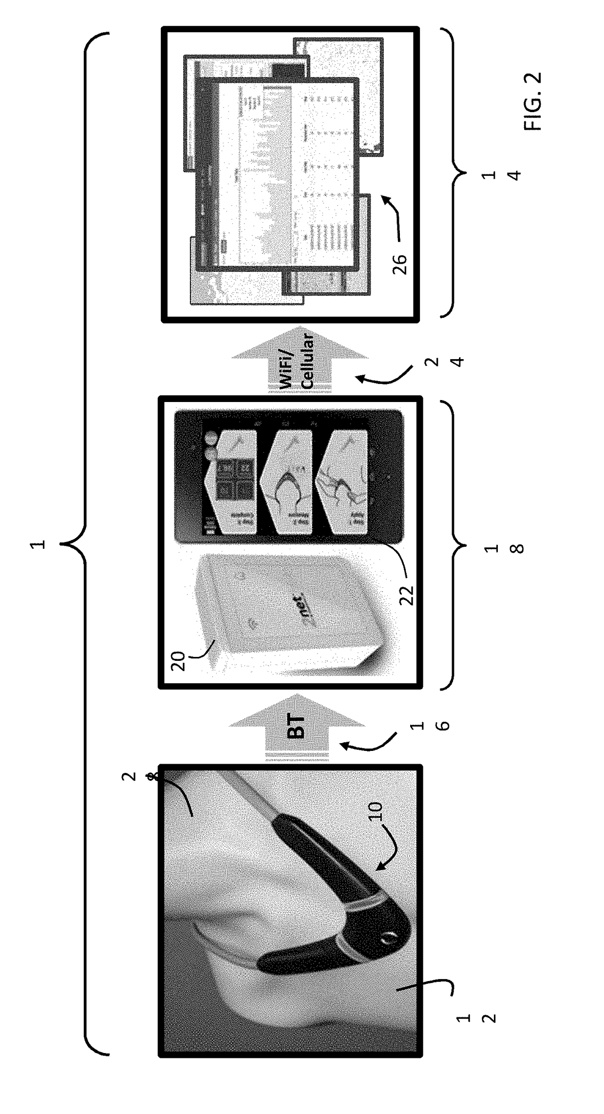 Neck-worn physiological monitor