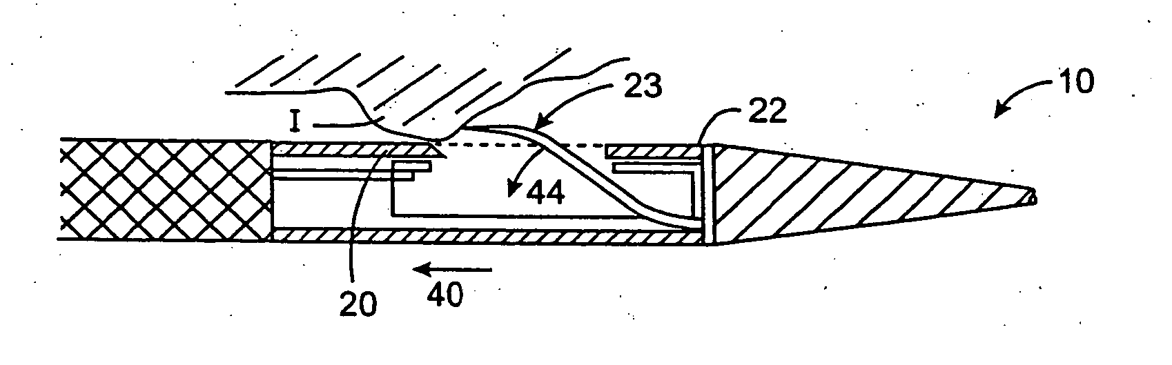 Apparatus and methods for material capture and removal