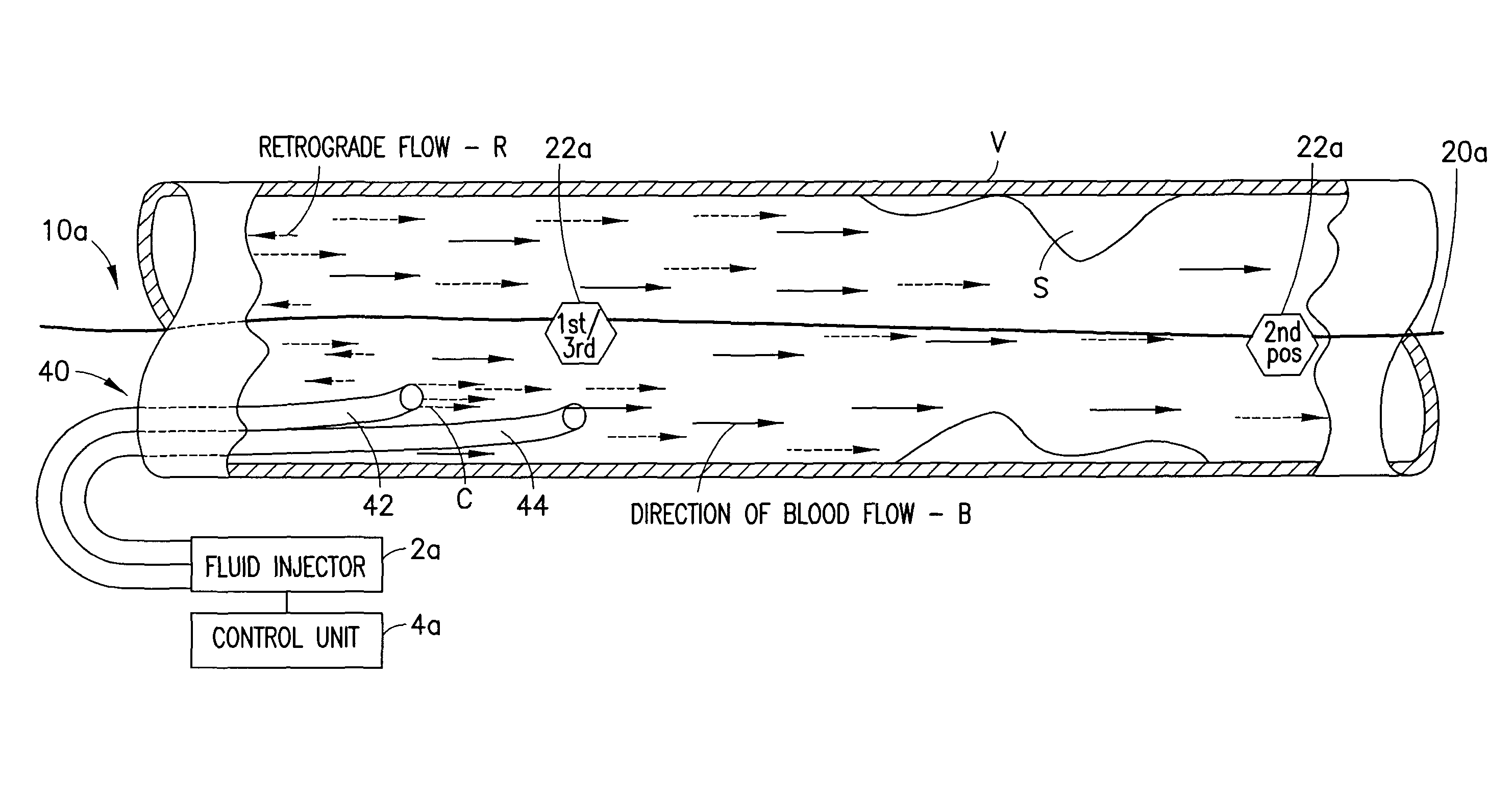 Method and apparatus for fractional flow reserve measurements