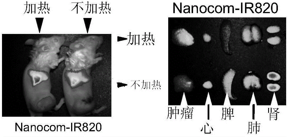 Gold-core-composite nano-carrier as well as preparation method and application thereof