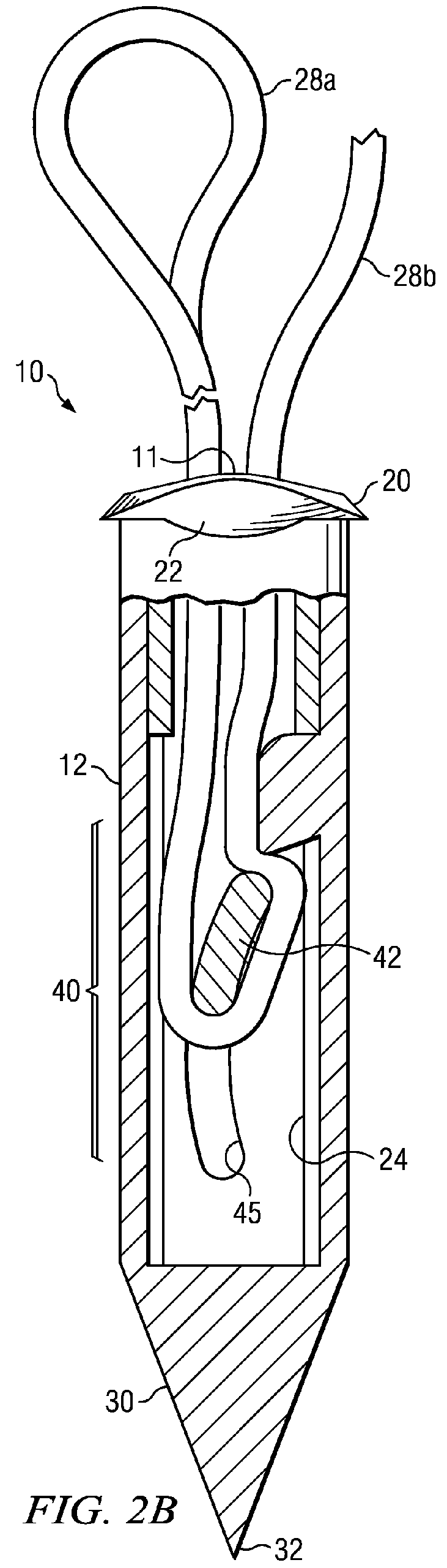 Restricted wedge suture anchor and method for soft tissue repair