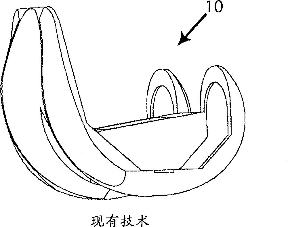 Posterior stabilized knee prosthesis