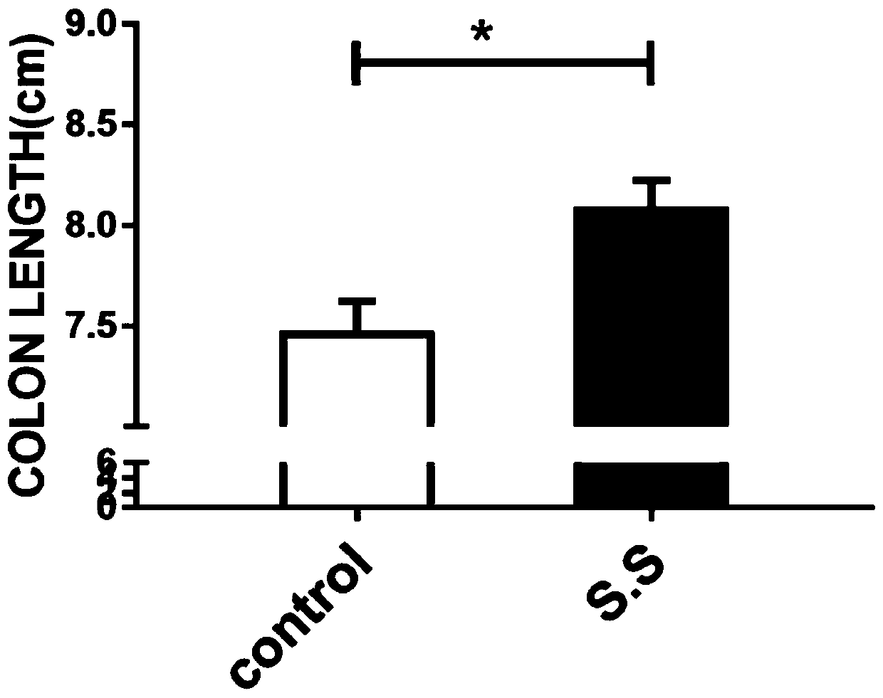 Streptococcus salivarius and application thereof to preparation of medicines for treatment of inflammatory bowel diseases