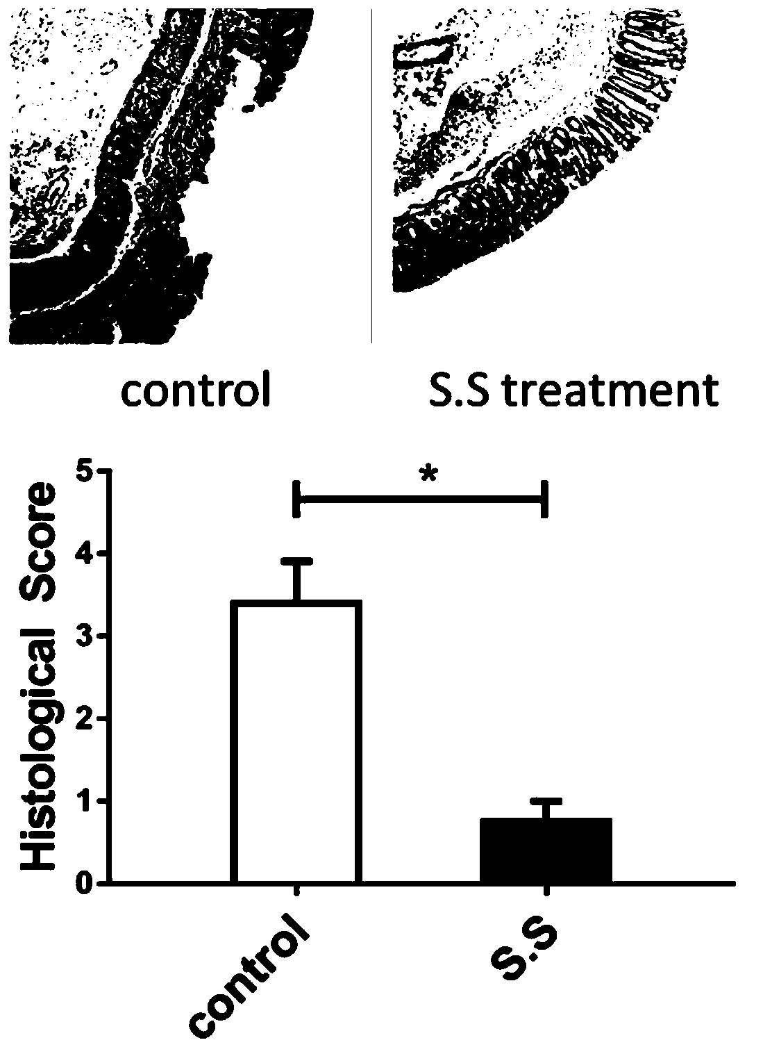 Streptococcus salivarius and application thereof to preparation of medicines for treatment of inflammatory bowel diseases