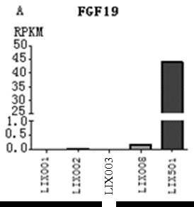 A human liver cancer cell line overexpressing fgf19 and its application