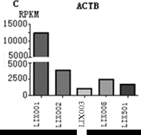 A human liver cancer cell line overexpressing fgf19 and its application