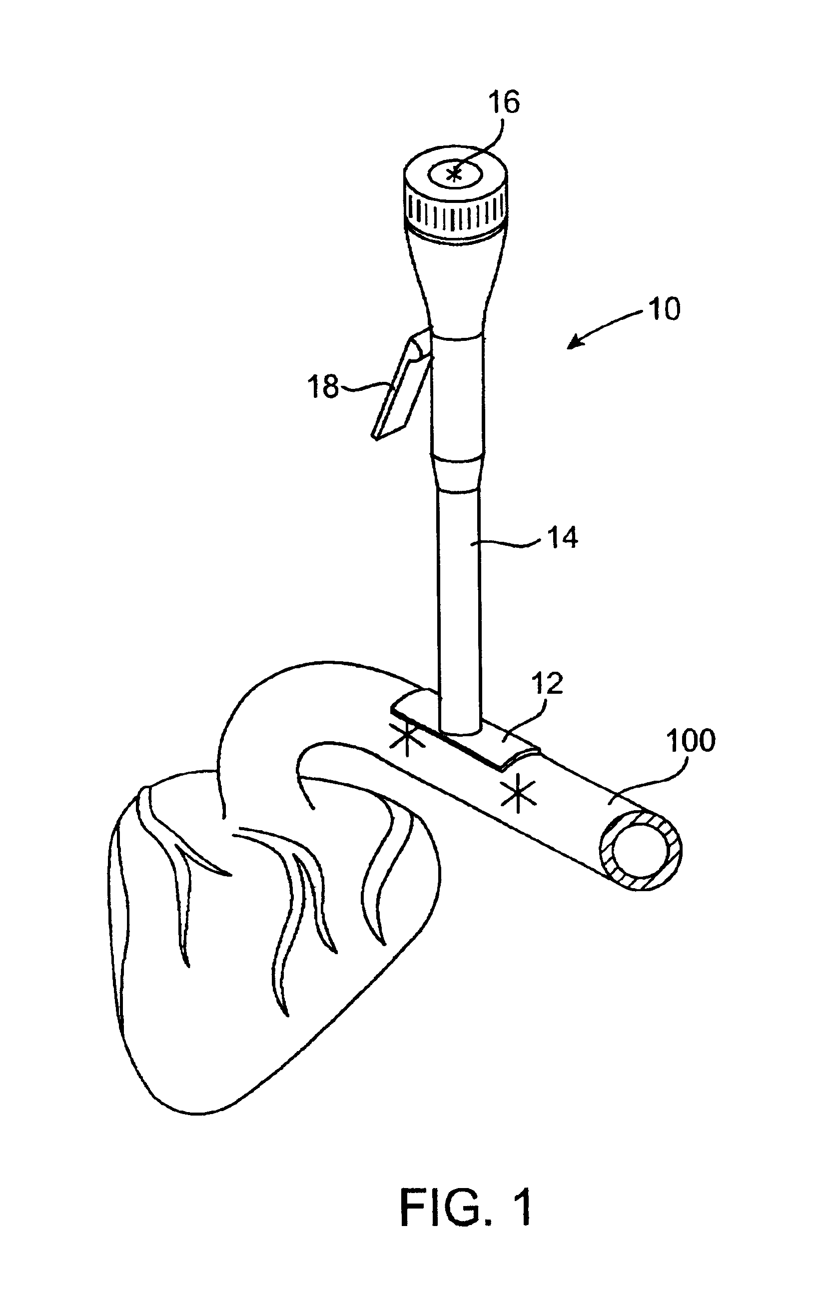 Access port system for anastomosis