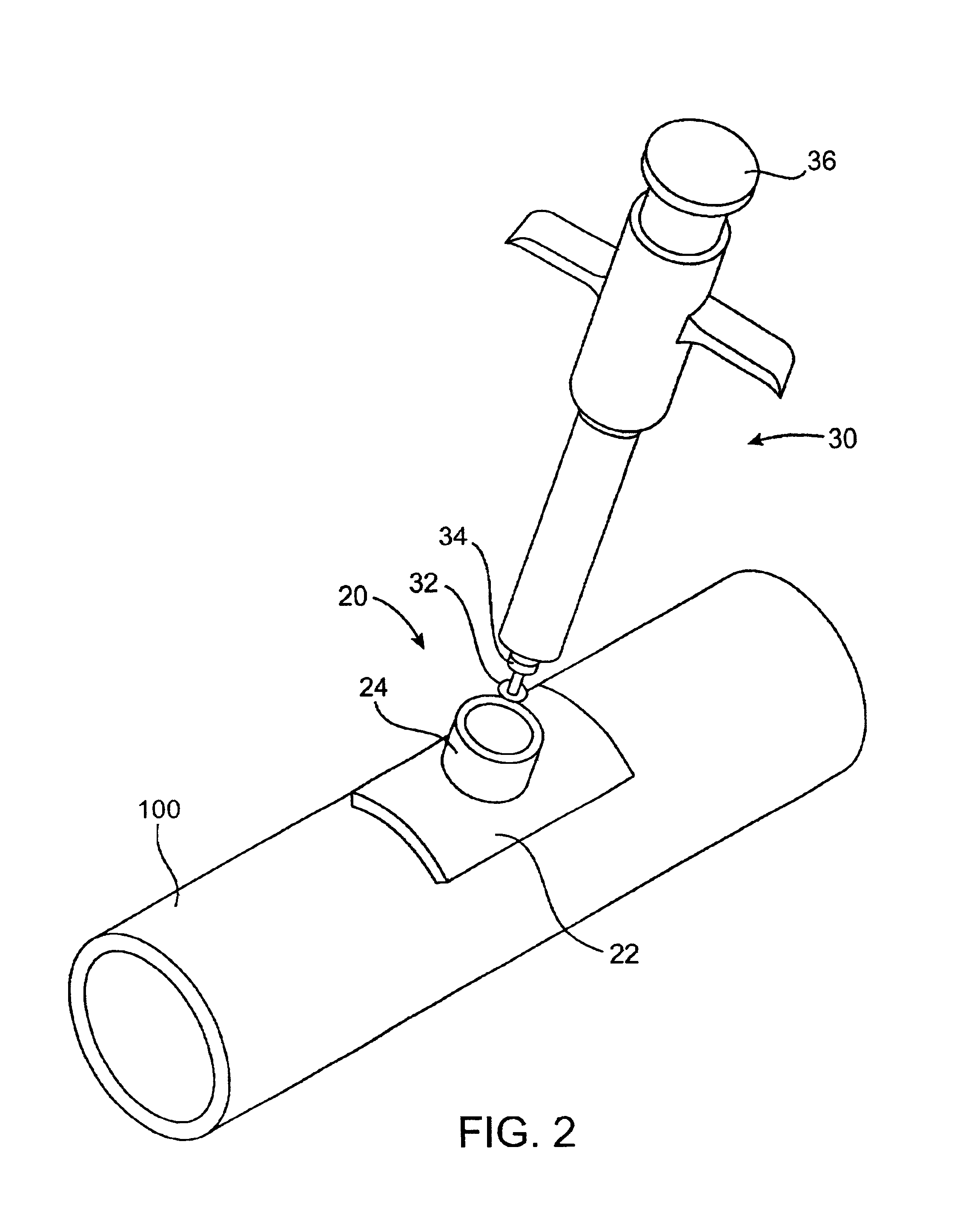 Access port system for anastomosis