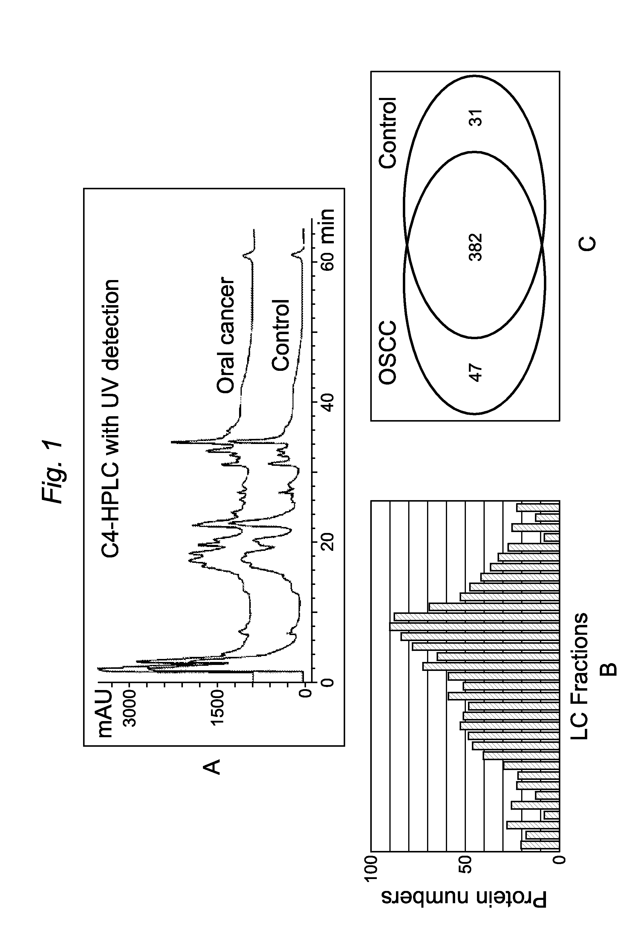 Salivary protein biomarkers for human oral cancer