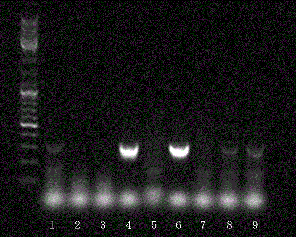 Nucleic acid sequence for typing detection of cutaneous human papillomavirus and application thereof