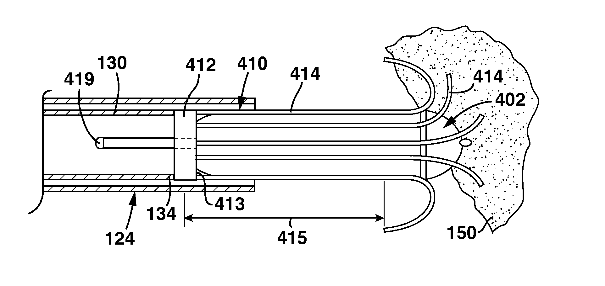 Slidable Fixation Device for  Securing a Medical Implant