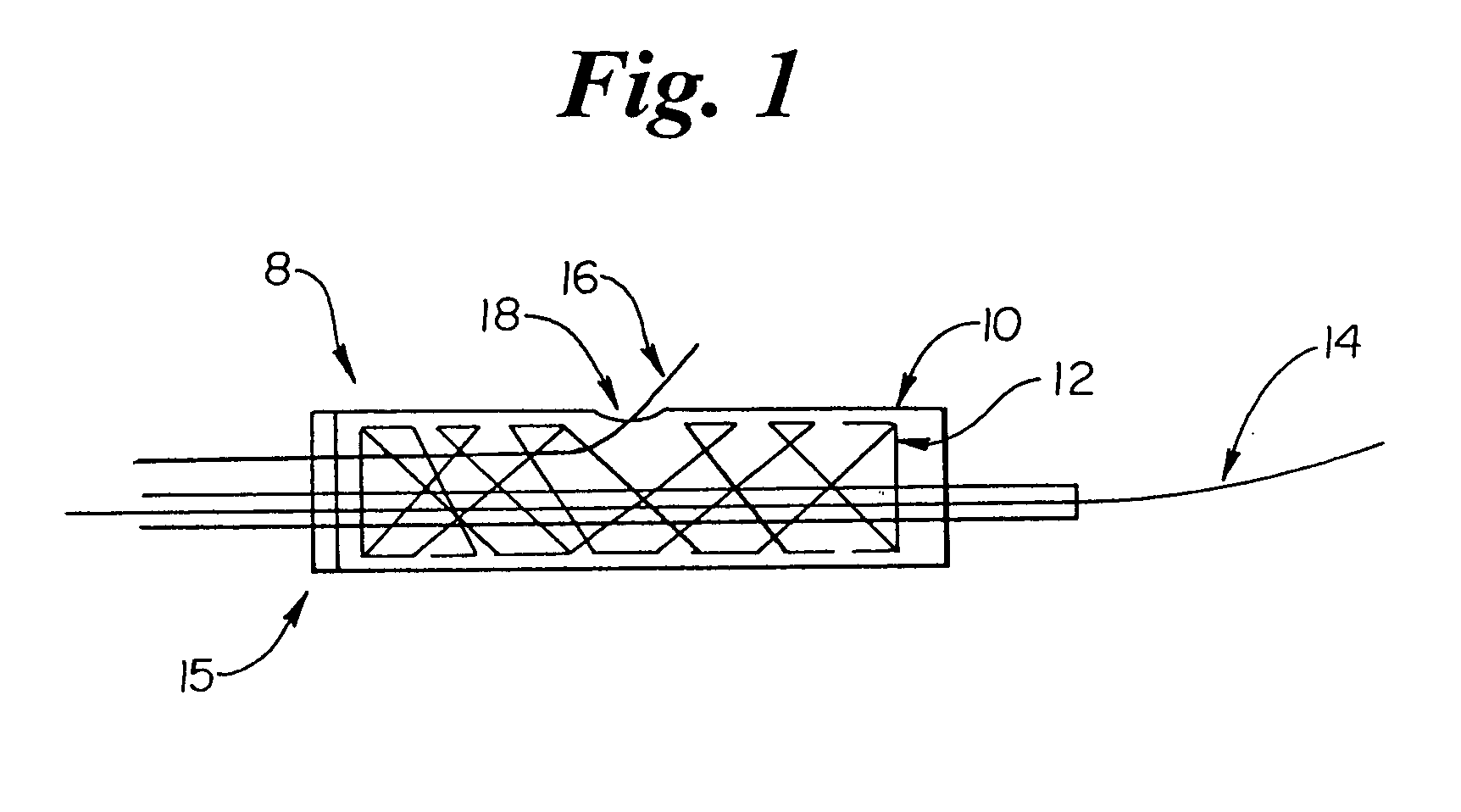 Clutch driven stent delivery system