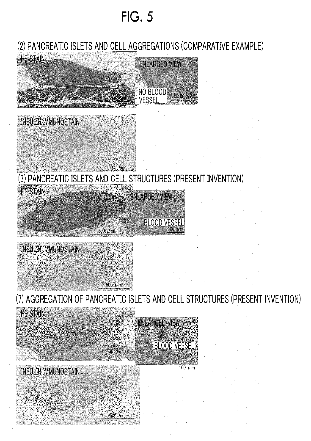 Composition, cell structure, pancreatic islet transplantation kit, pancreatic islet cell transplantation treatment agent and hypoglycemic agent, composition containing pancreatic islet, kit containing pancreatic islet, and pancreatic islet transplantation treatment agent and hypoglycemic agent