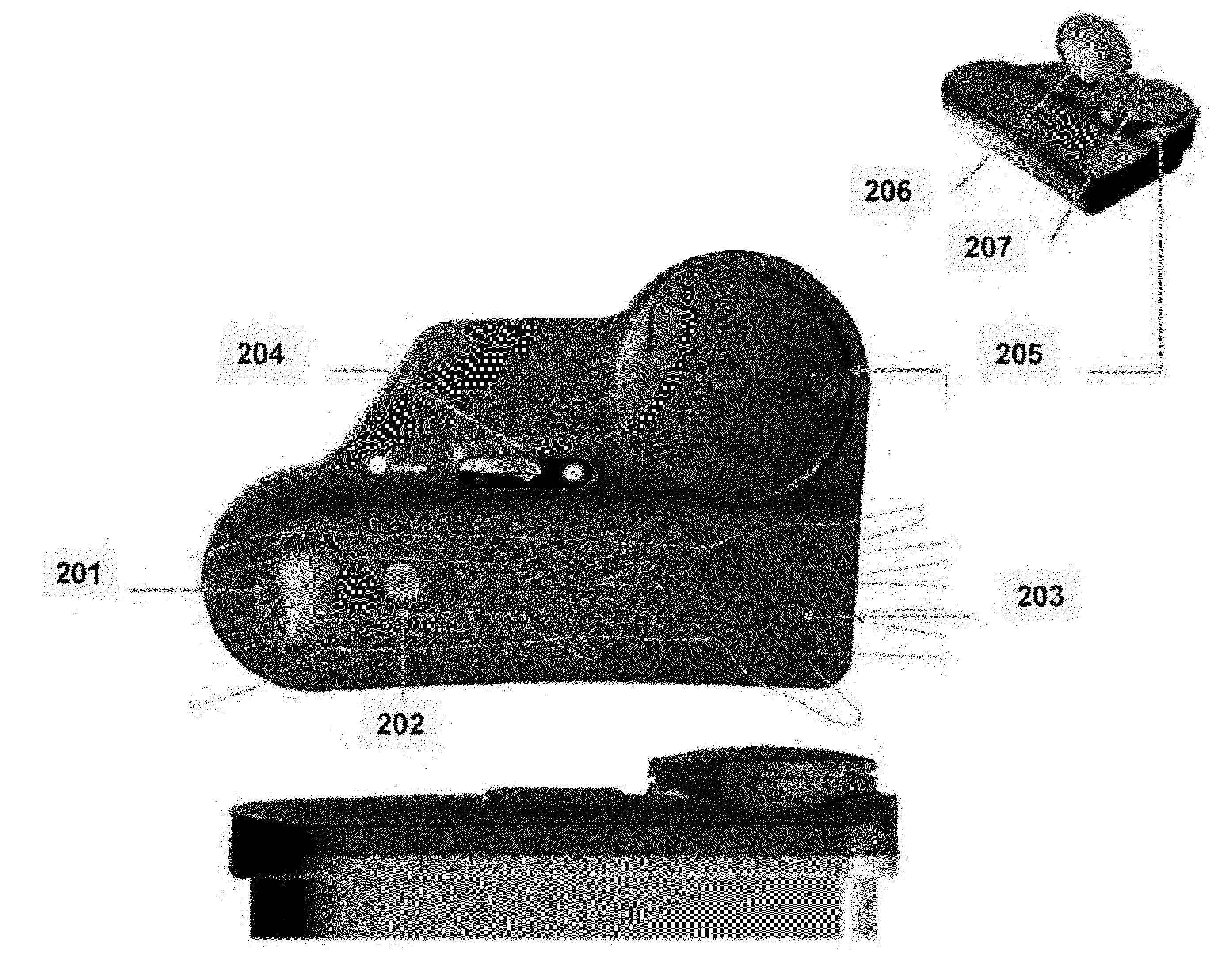 Method and Apparatus for Determination of a Measure of a Glycation End-Product or Disease State Using Tissue Fluorescence