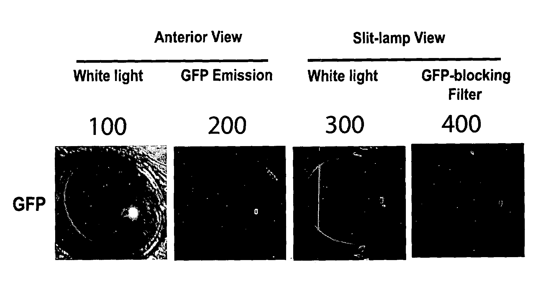 Non-invasive methods and related compositions for identifying compounds that modify in vivo aggregations of disease-related polypeptides