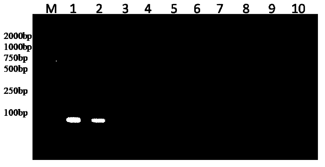 Nested RT-PCR(reverse transcription-polymerase chain reaction)kit and method for detecting porcine Kobuvirus