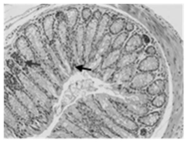 Application of Shengjiang Xiexin Decoction in the Treatment of Diarrhea Caused by Clostridium difficile Infection