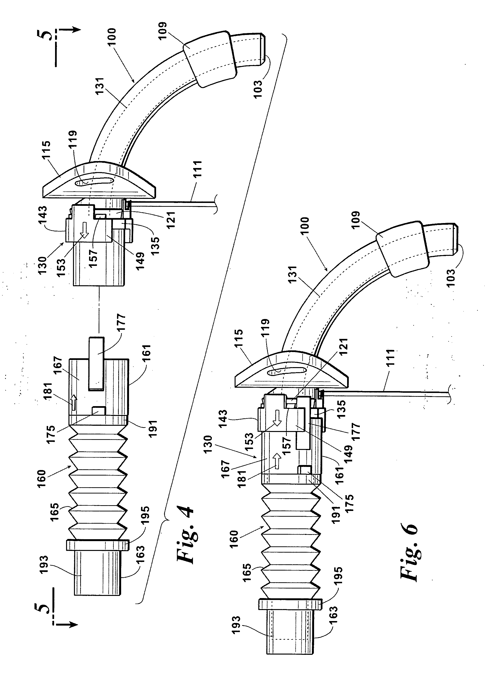 Ventilator to tracheotomy tube coupling