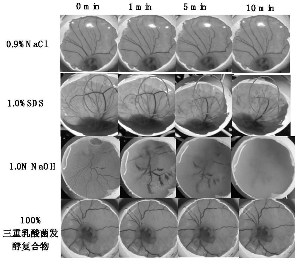 Preparation method and application of triple probiotic fermentation compound with anti-inflammatory effect