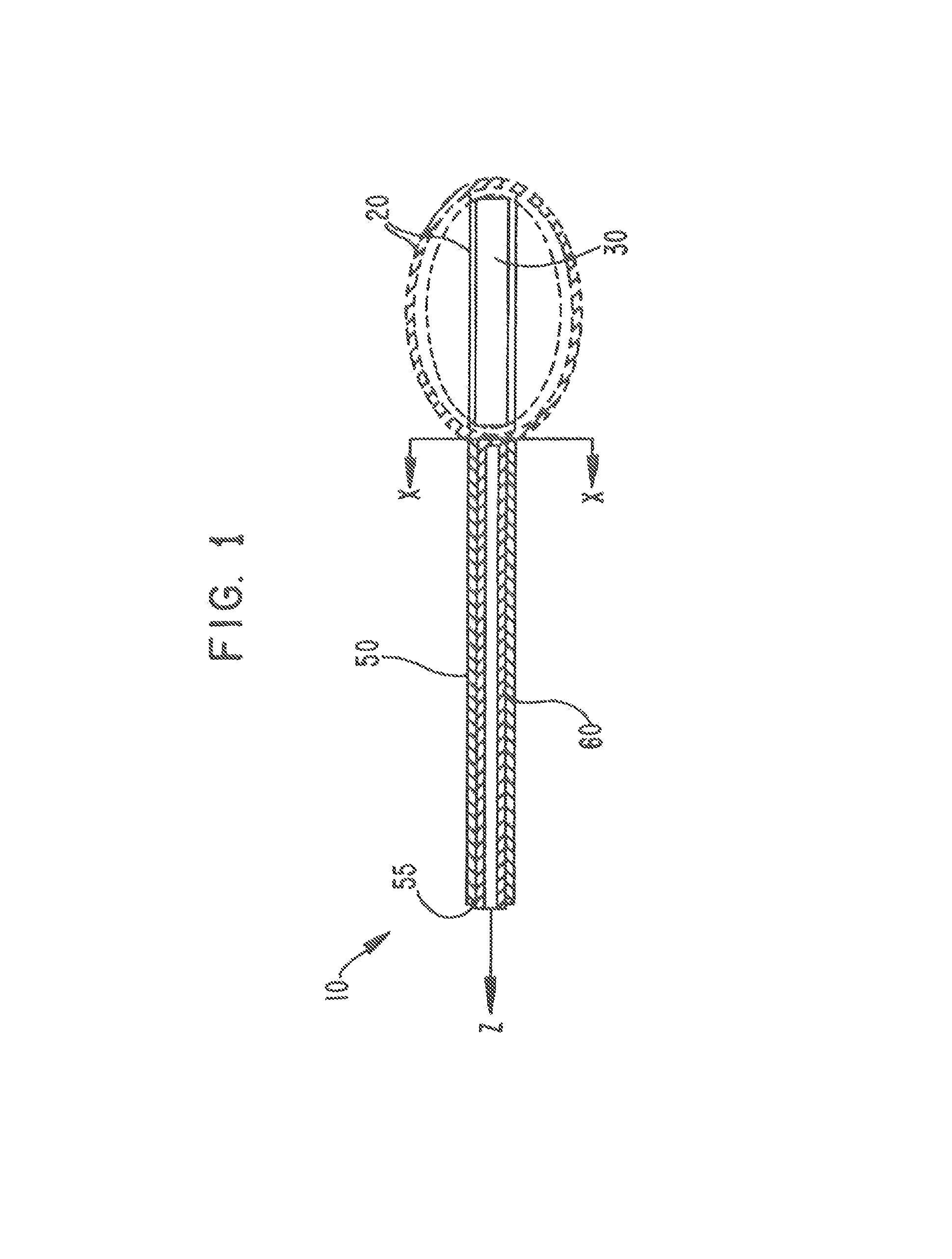 Selectively-expandable bone scaffold