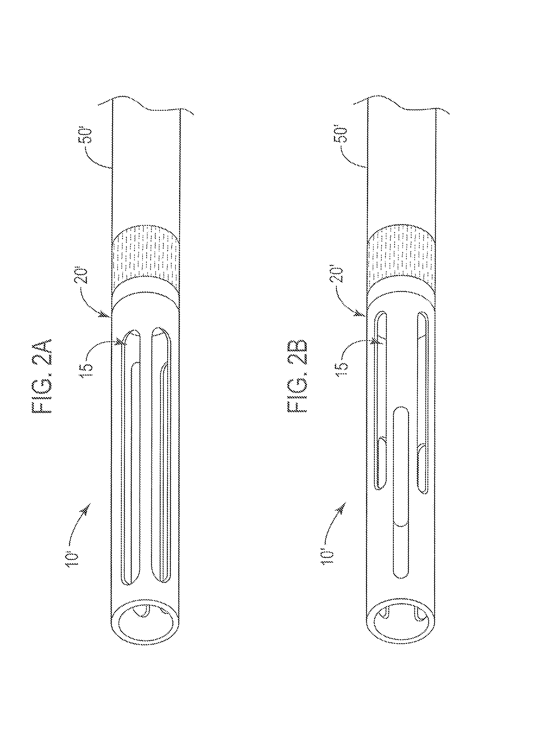 Selectively-expandable bone scaffold