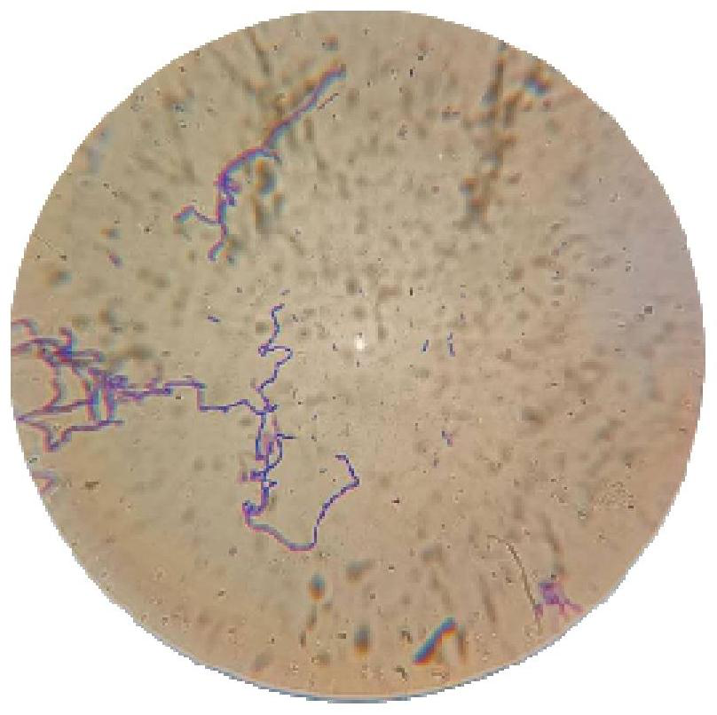 A kind of Lactobacillus gasseri and its application in the preparation of fermented milk