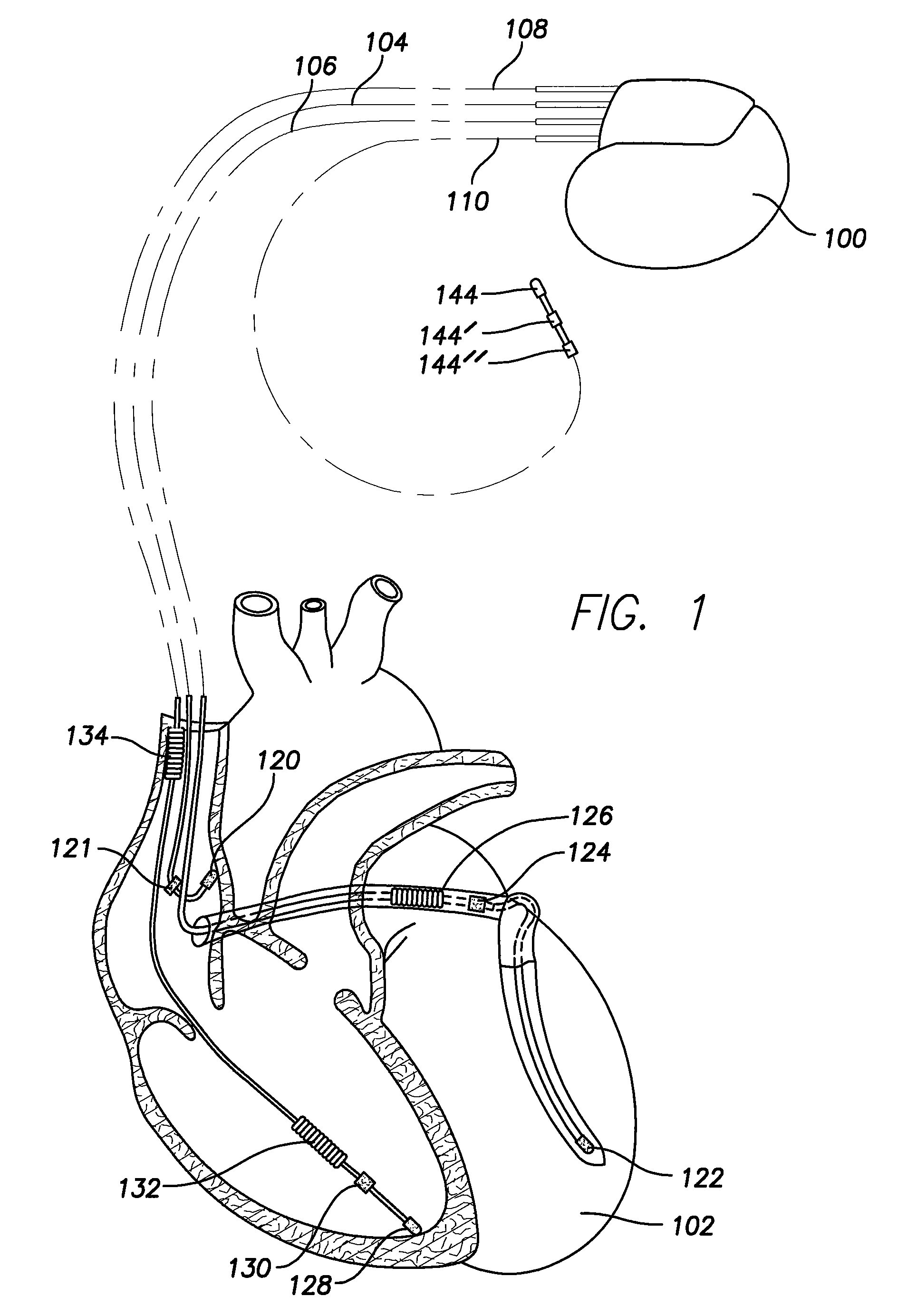 Small caliber implantable biometric leads and cables for same