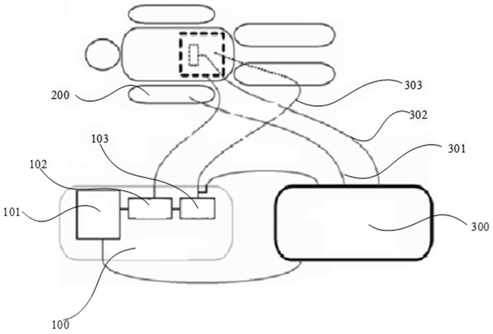 Ablation system