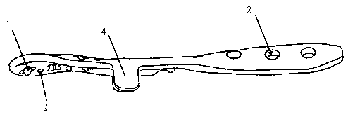 Encircling bone bonding plate for fibula distal-end B-type fracture