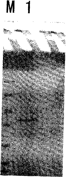 Establishment of method for preparing recombinant protein vaccine of type A H1N1 influenza virus