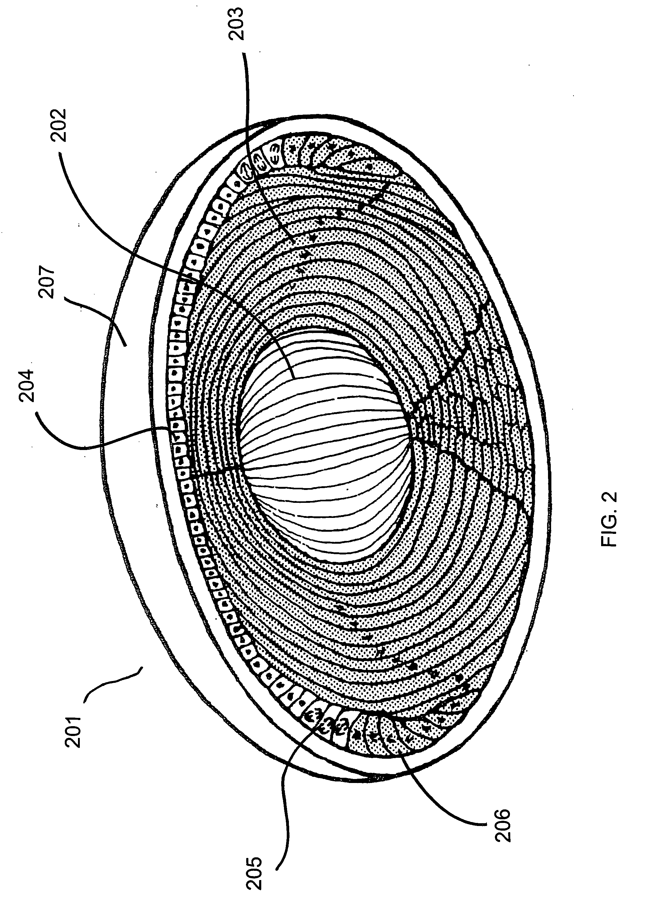 Apparatus and processes for preventing or delaying one or more symptoms of presbyopia