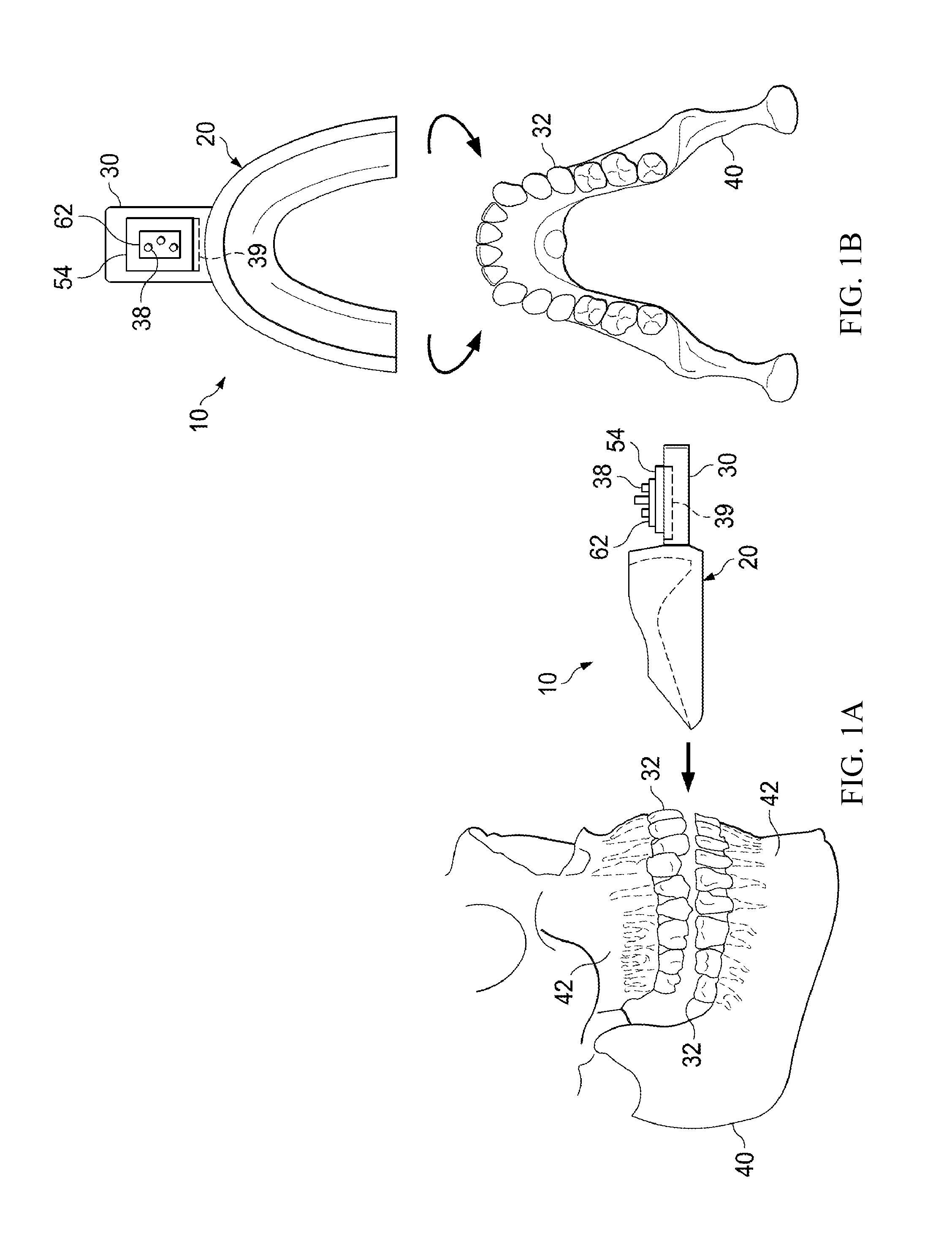 Vibrating orthodontic remodeling device and method thereof