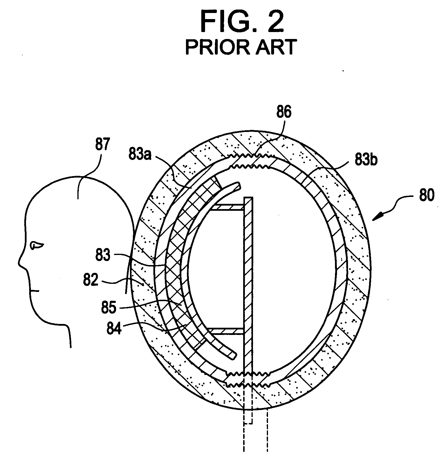 Energy absorbing support for vehicular passengers