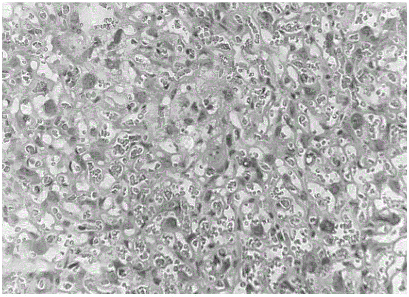 Applications of recombinant high-density lipoprotein in treating hypertensive disorders in pregnancy