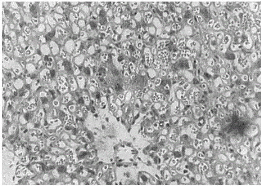 Applications of recombinant high-density lipoprotein in treating hypertensive disorders in pregnancy