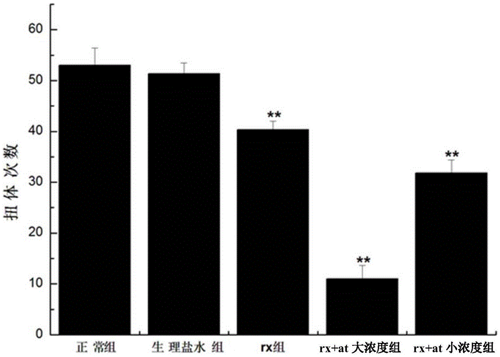 Traditional Chinese medicine composition for alleviating ache, its extract product, preparation method and application thereof