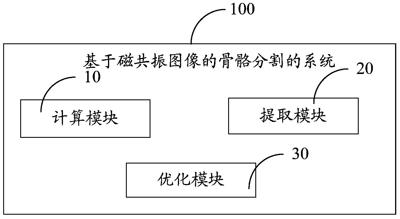 Magnetic resonance image-based bone segmentation method and system thereof