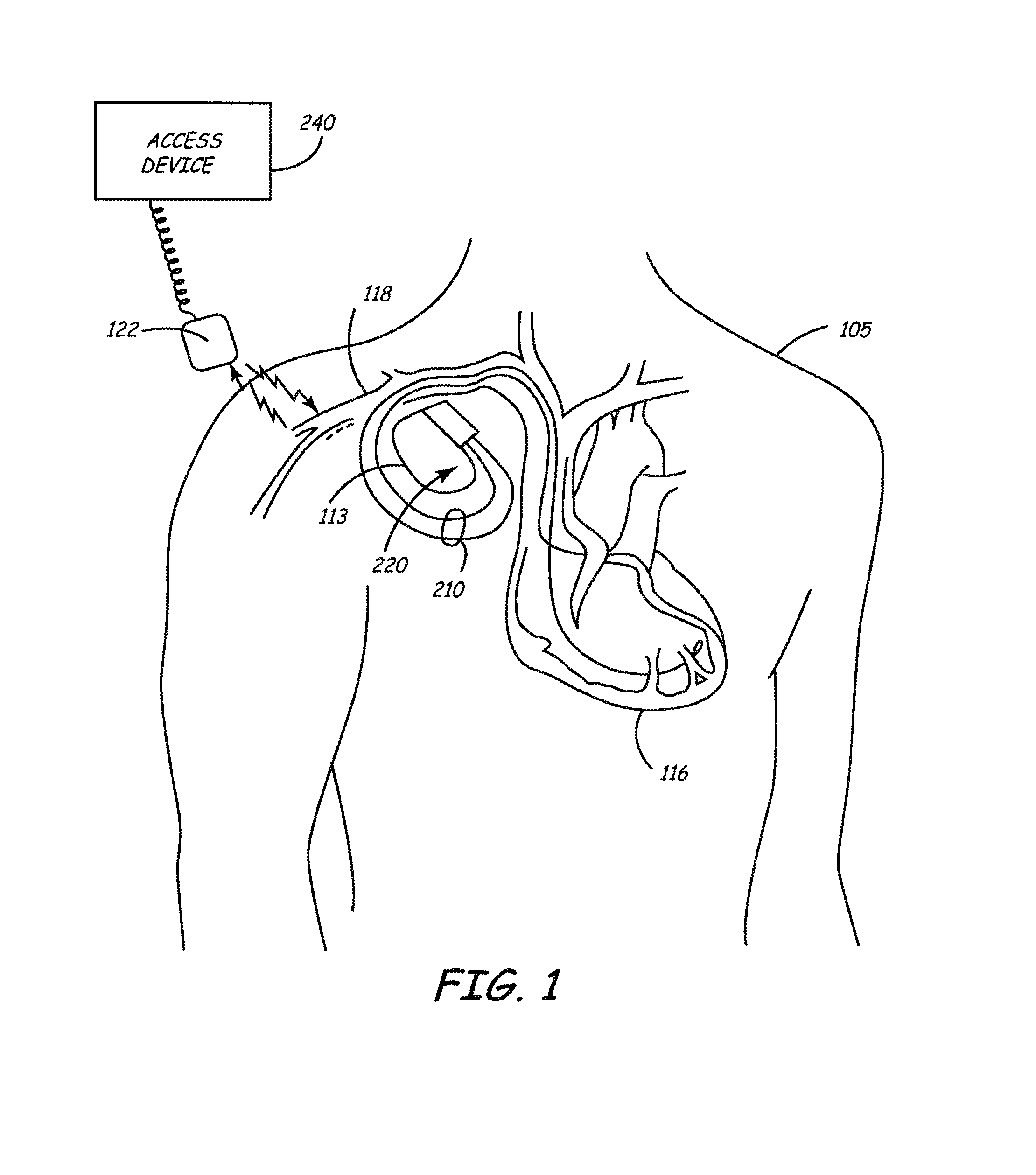 Method and apparatus for writing data between fast and slow clock domains