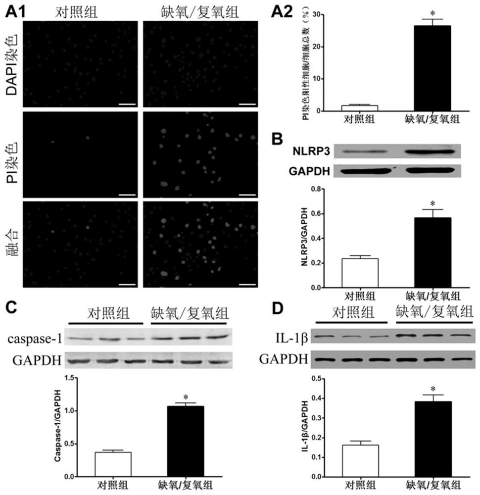 Model construction of influence of endoplasmic reticulum stress on NLRP3 on myocardial ischemia