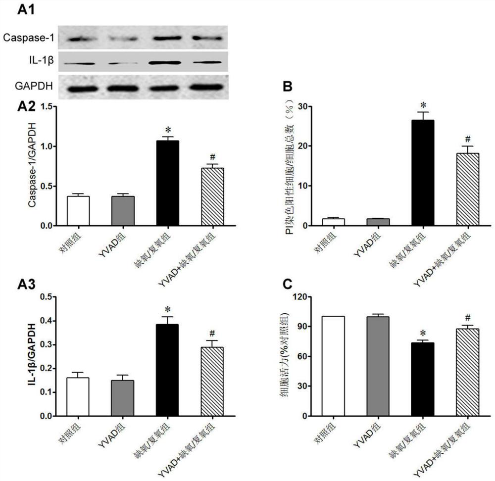 Model construction of influence of endoplasmic reticulum stress on NLRP3 on myocardial ischemia