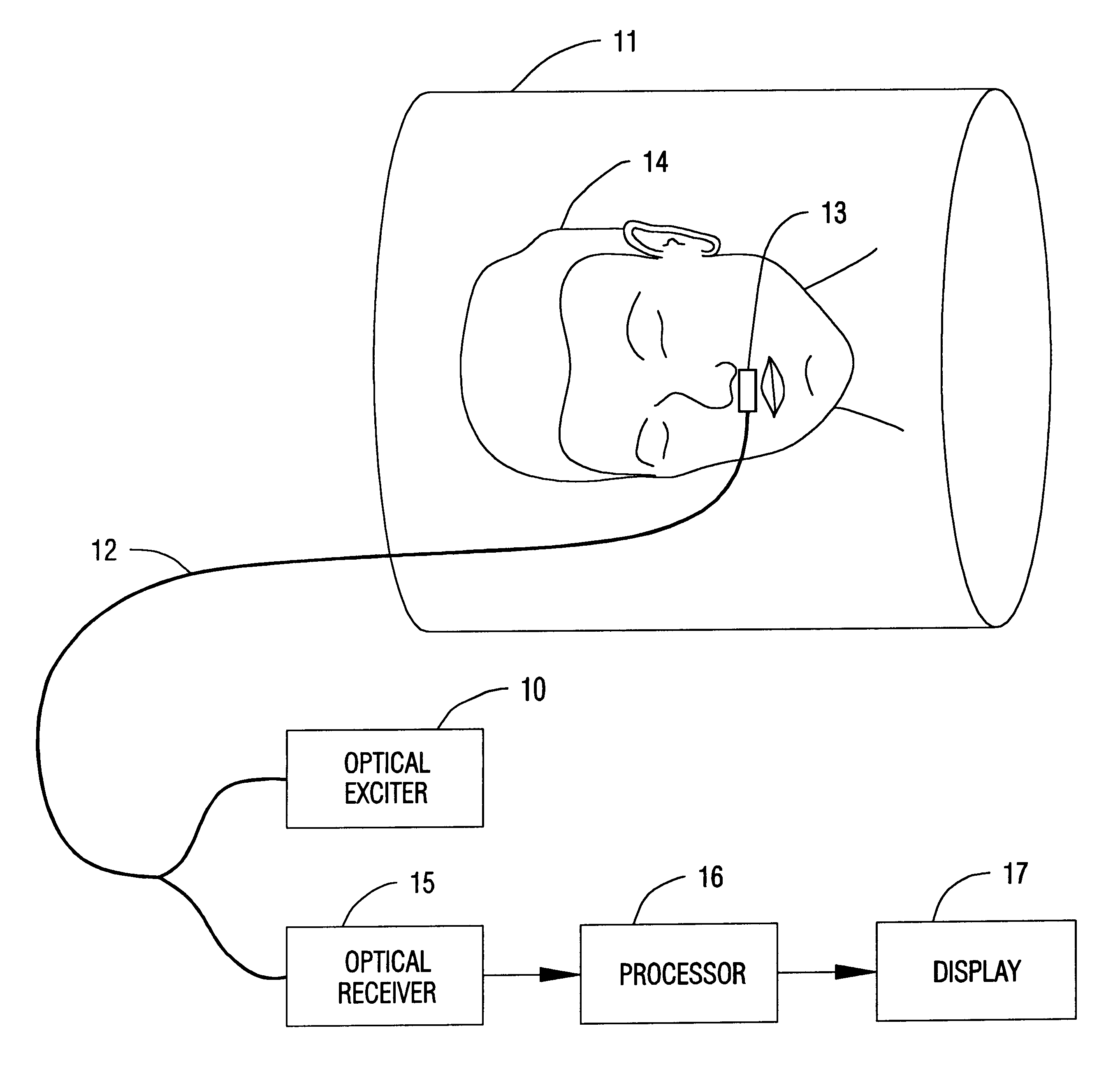 Method and apparatus for monitoring the breathing of a patient during magnetic resonance imaging