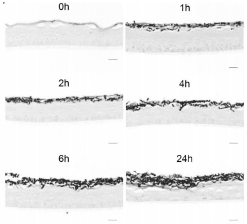 Model for simulating dermatophyte infection in vitro and establishment method and application thereof