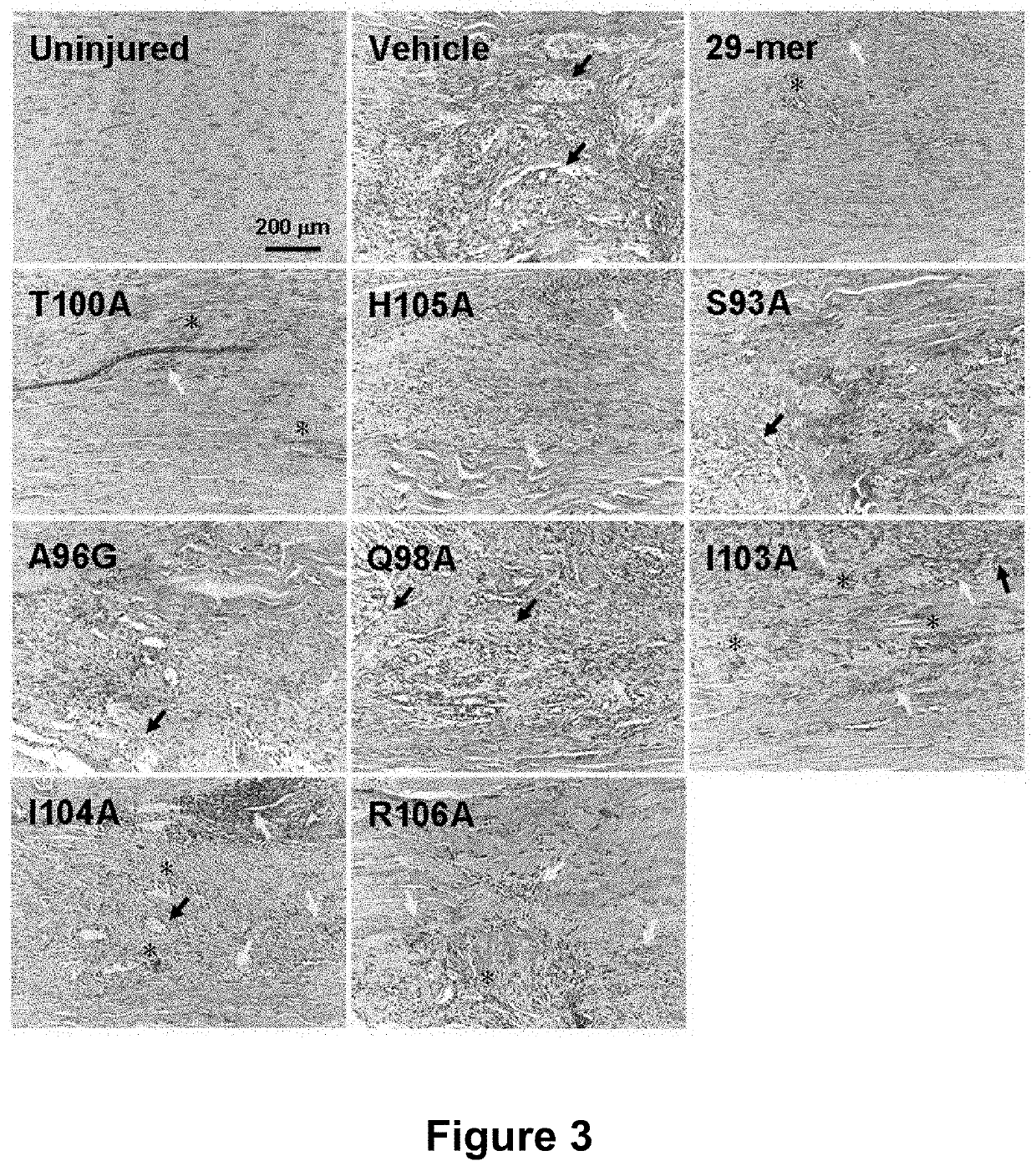 Application of pedf-derived short peptides in tendon healing