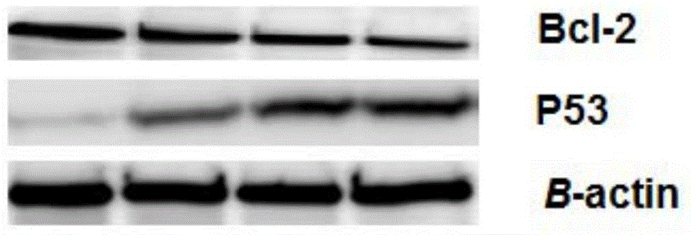 Application of triterpene glucoside or pharmaceutically acceptable salts thereof in preparation of tumor radiosensitizer