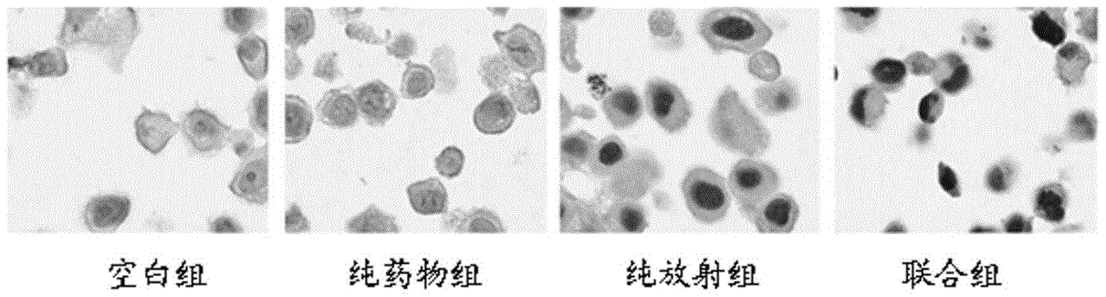 Application of triterpene glucoside or pharmaceutically acceptable salts thereof in preparation of tumor radiosensitizer