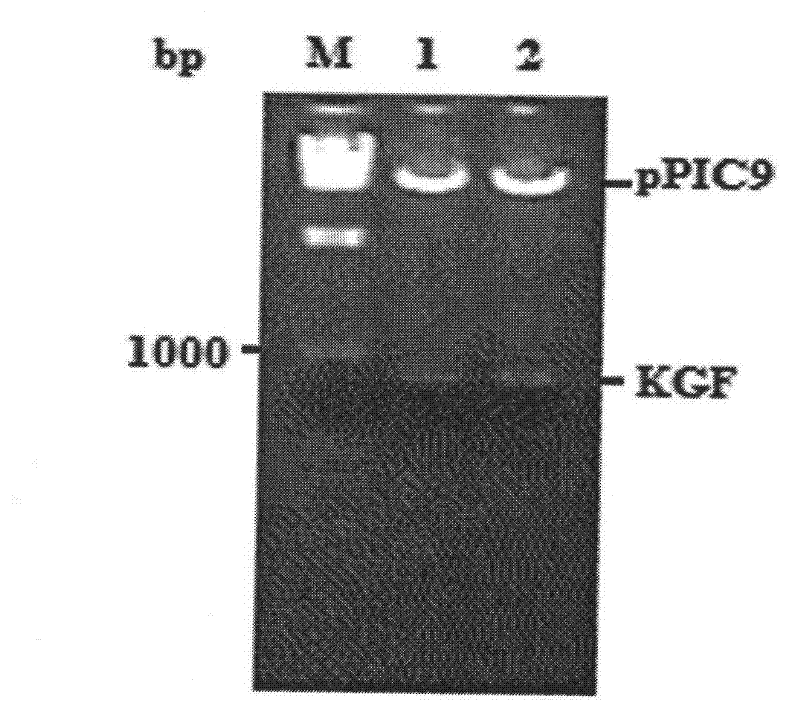 Modified Keratinocyte growth factor gene and its expression in yeast