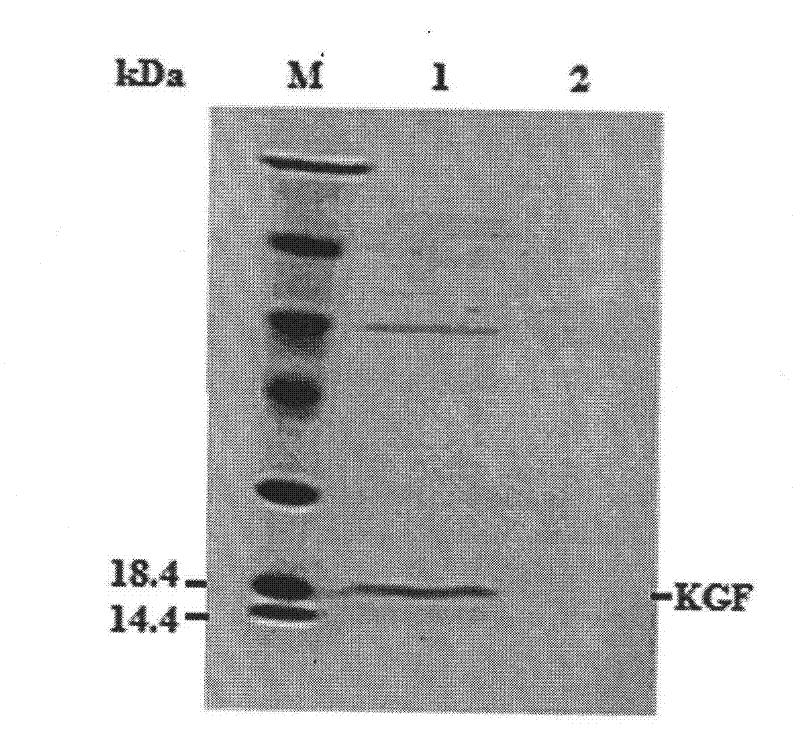 Modified Keratinocyte growth factor gene and its expression in yeast