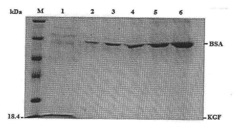 Modified Keratinocyte growth factor gene and its expression in yeast