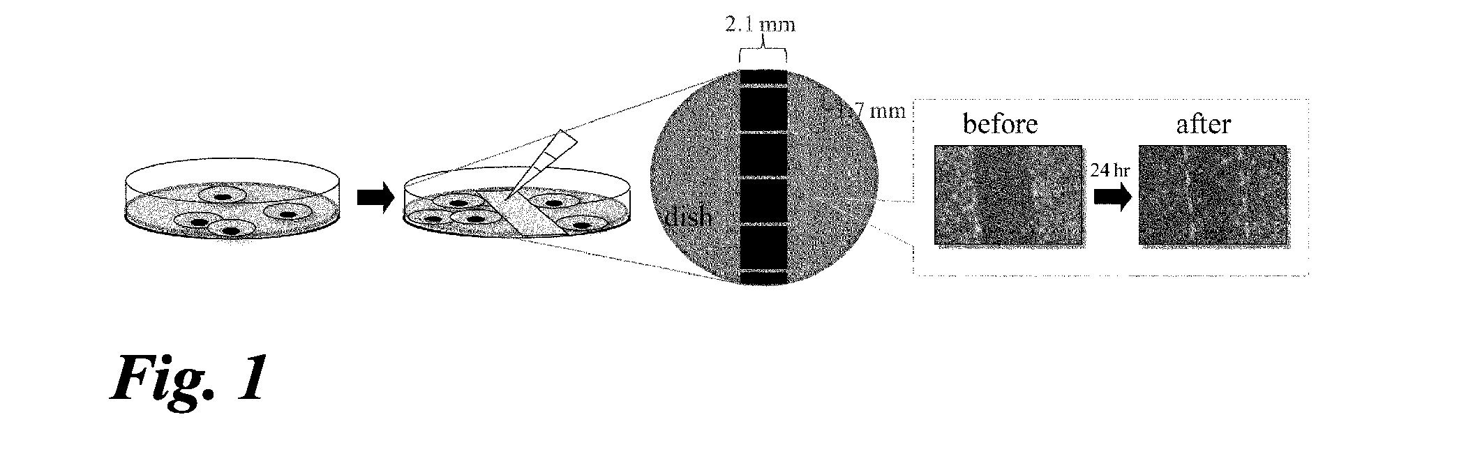 Intraocular angiogenesis inhibitor and uses thereof